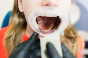 Managing Dental Trauma: Protecting Your Smile Through Life's Accidents